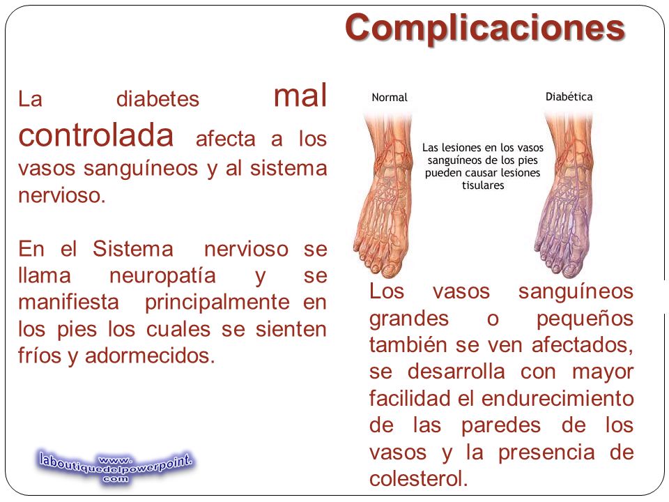 diabetes mellitus mal controlada
